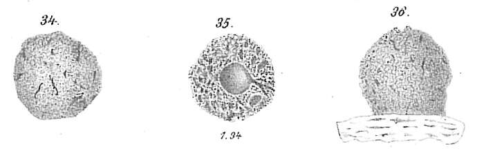 Image de Crithionina mamilla Goës 1894