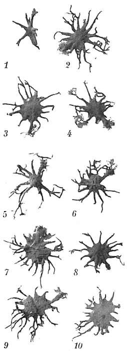 Image de Astrorhiza limicola Sandahl 1858