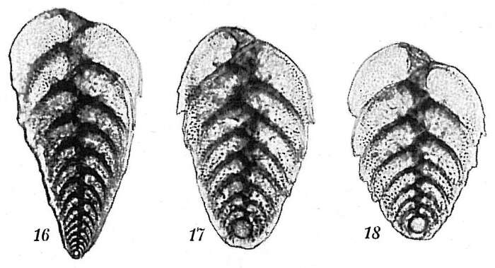 Image de Bolivina robusta (Brady 1881)