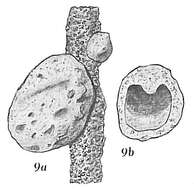 Image de Crithionina mamilla Goës 1894