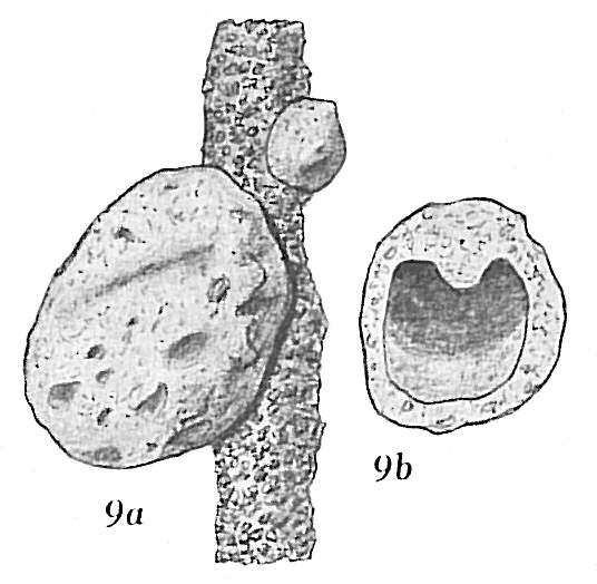 Image de Crithionina mamilla Goës 1894