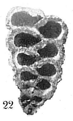 Слика од Dorothia pseudoturris (Cushman 1922)