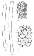 Image de Hyperammina elongata Brady 1878