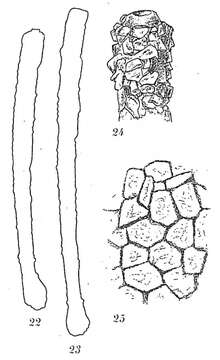 Image de Hyperammina elongata Brady 1878