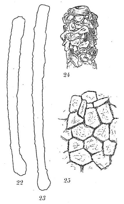 Image de Hyperammina elongata Brady 1878