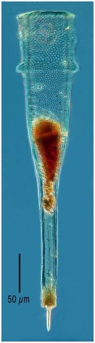 Imagem de Xystonellopsis pulchra Kofoid 1905