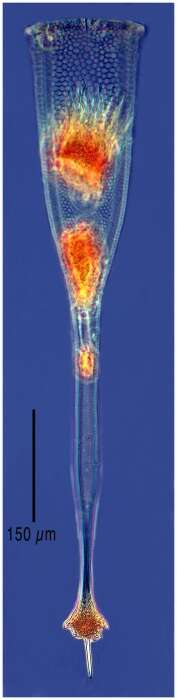 Image of Xystonellopsis clevei Kofoid & Campbell 1929