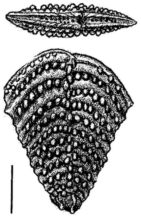 Image of Nodobolivinella nodosa Hayward 1990