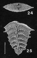 Imagem de Rugobolivinella spinosa (Hayward ex Hayward & Brazier 1980)