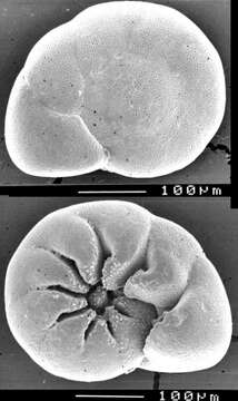 Image of Ammonia advena (Cushman 1922)