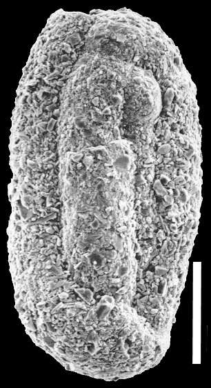 Image of Miliamminidae