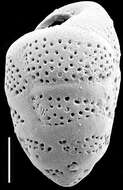 Image de Virgulopsis turris (Heron-Allen & Earland 1922)