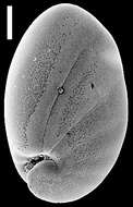 Image de Nonionella magnalingua Finlay 1940