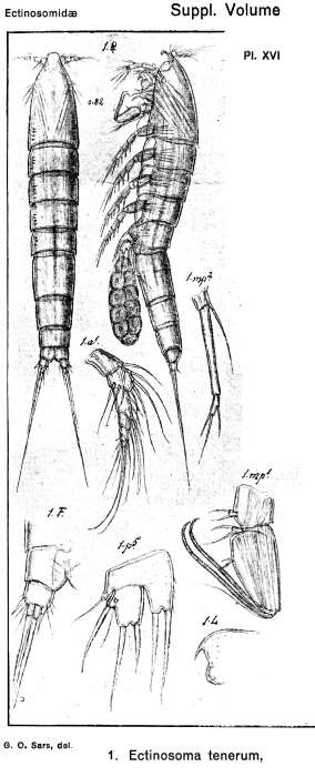 Image de Ectinosoma tenerum Sars G. O. 1920
