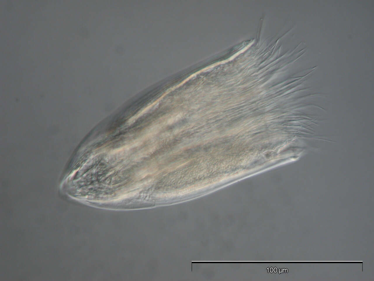 Image of Spinoloricus Heiner & Neuhaus 2007