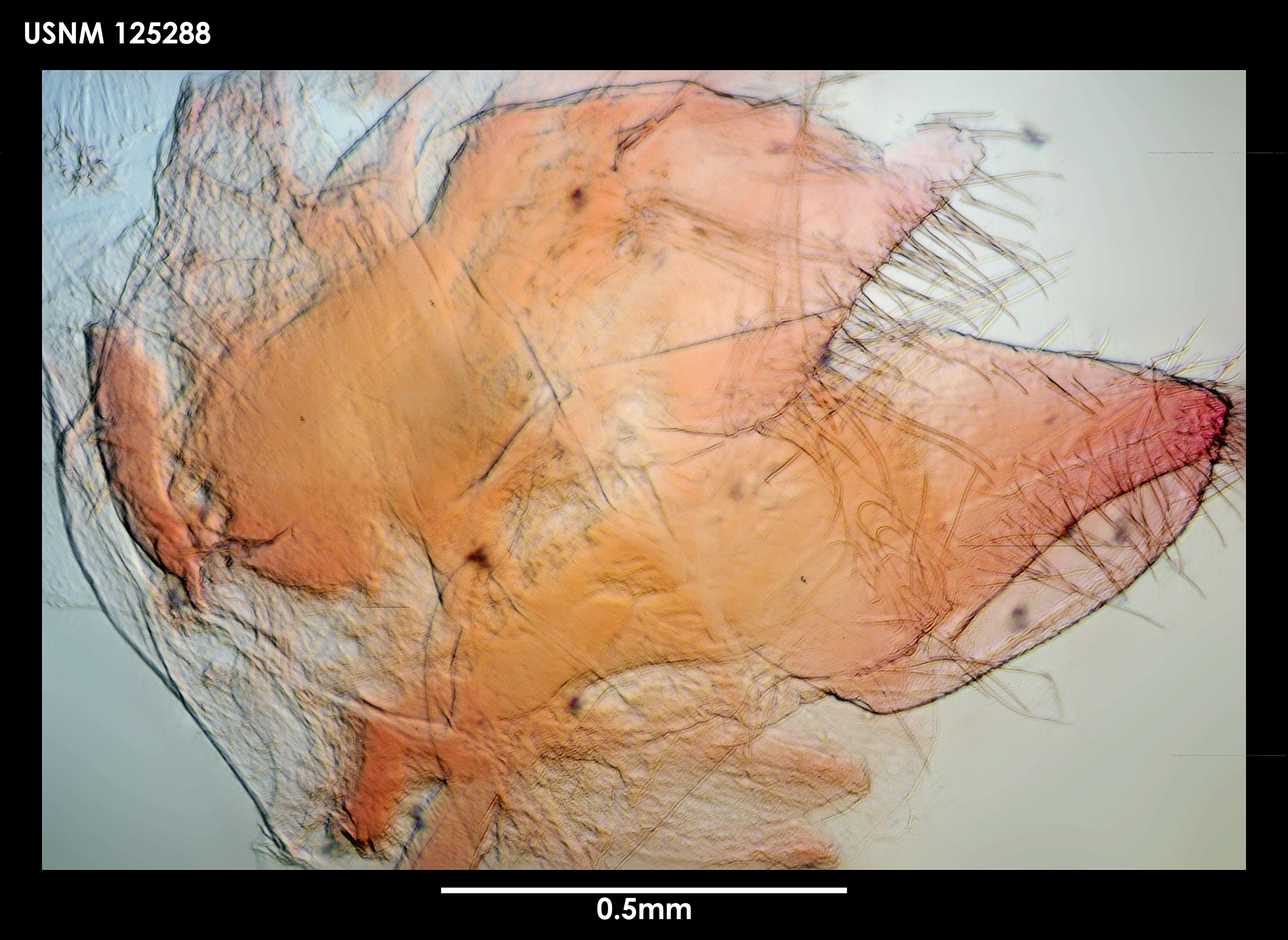 Image of Weltnerium gibberum (Aurivillius 1898)