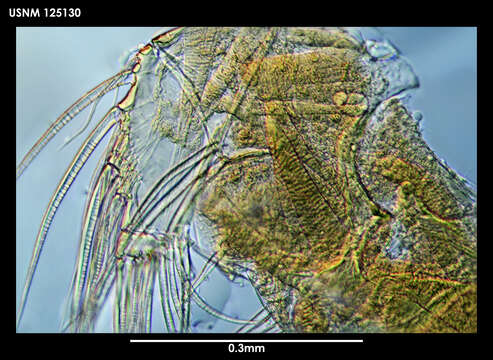 Image de Parasterope Kornicker 1975