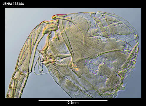 Image of Philomedes cubitum Kornicker 1975