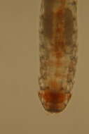 Image of Echinoderes sensibilis Adrianov, Murakami & Shirayama 2002