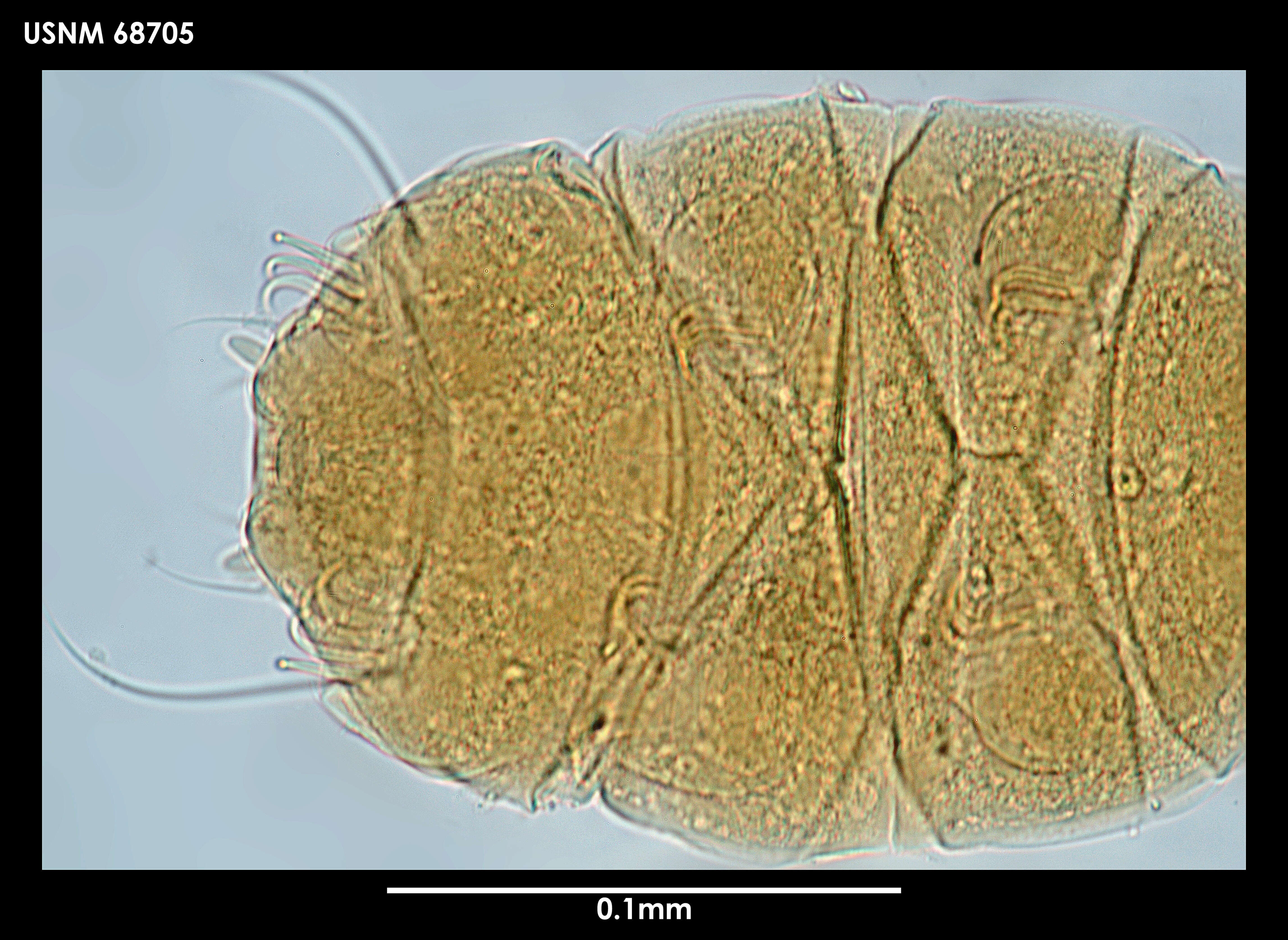 Image de Echiniscus jenningsi Dastych 1984