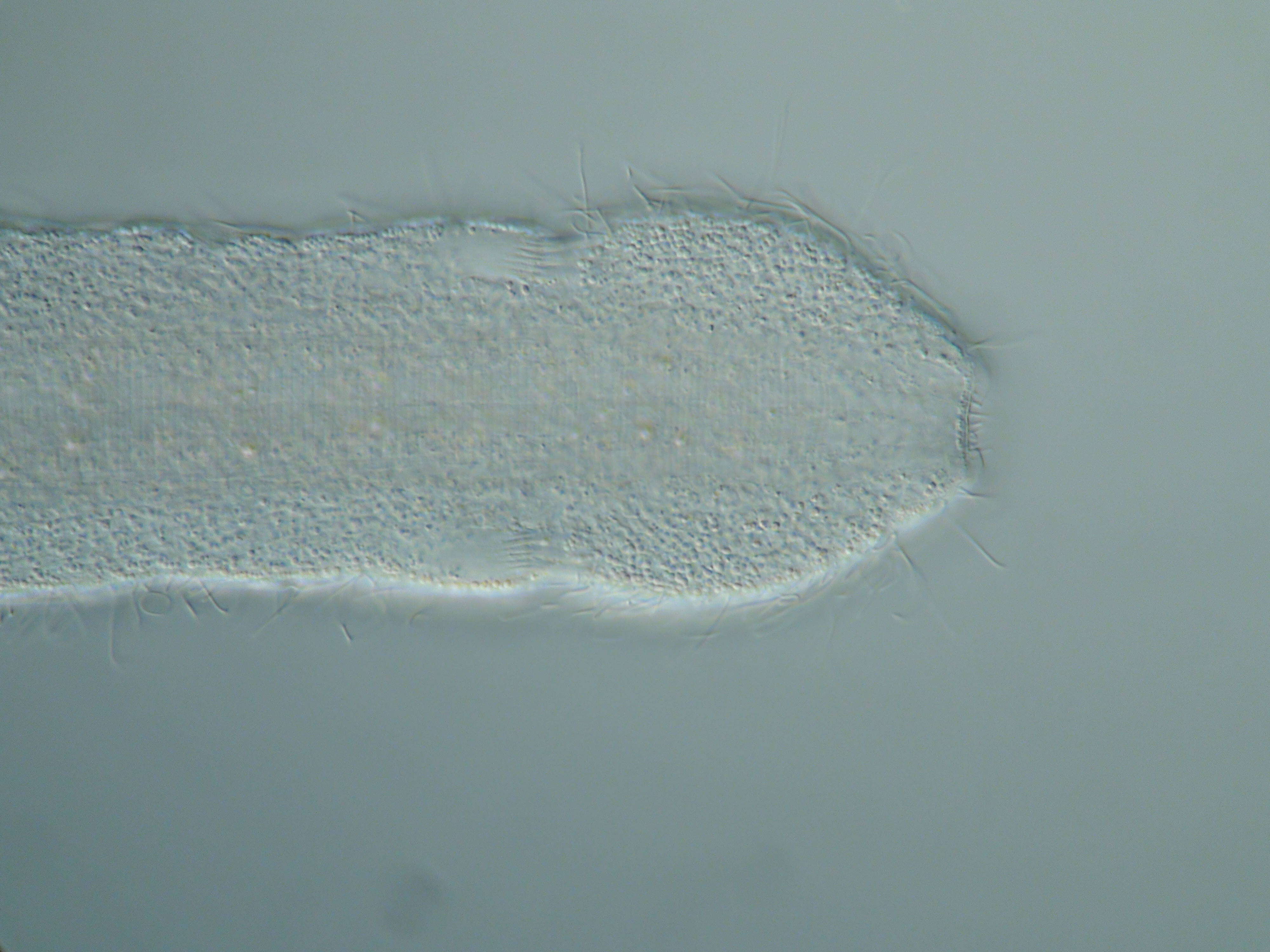 Слика од Cephalodasys interinsularis Kieneke, Schmidt-Rhaesa & Hochberg 2015