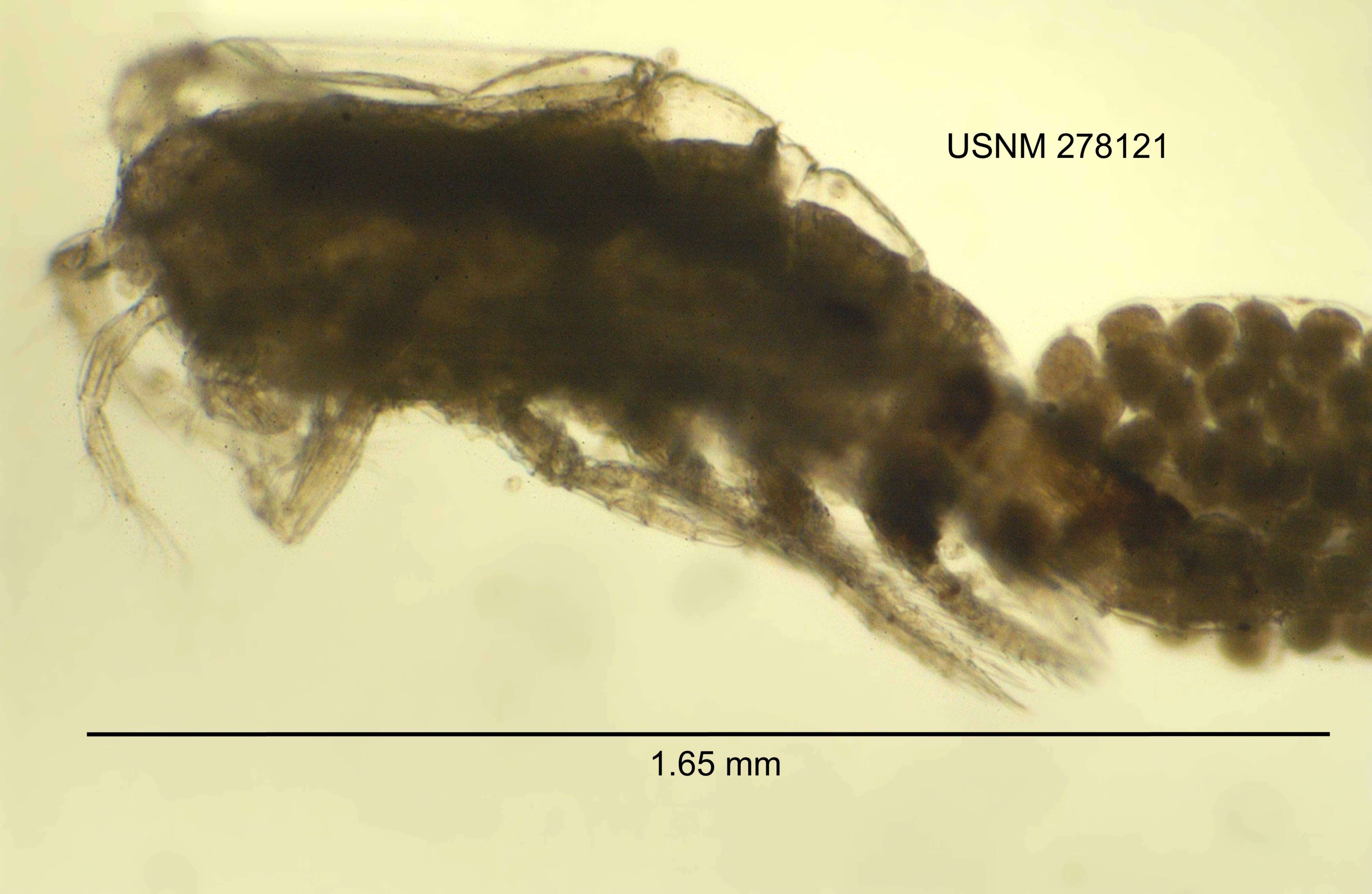 Image de <i>Acanthocyclops robustus</i>