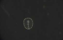 Image of segmented worms