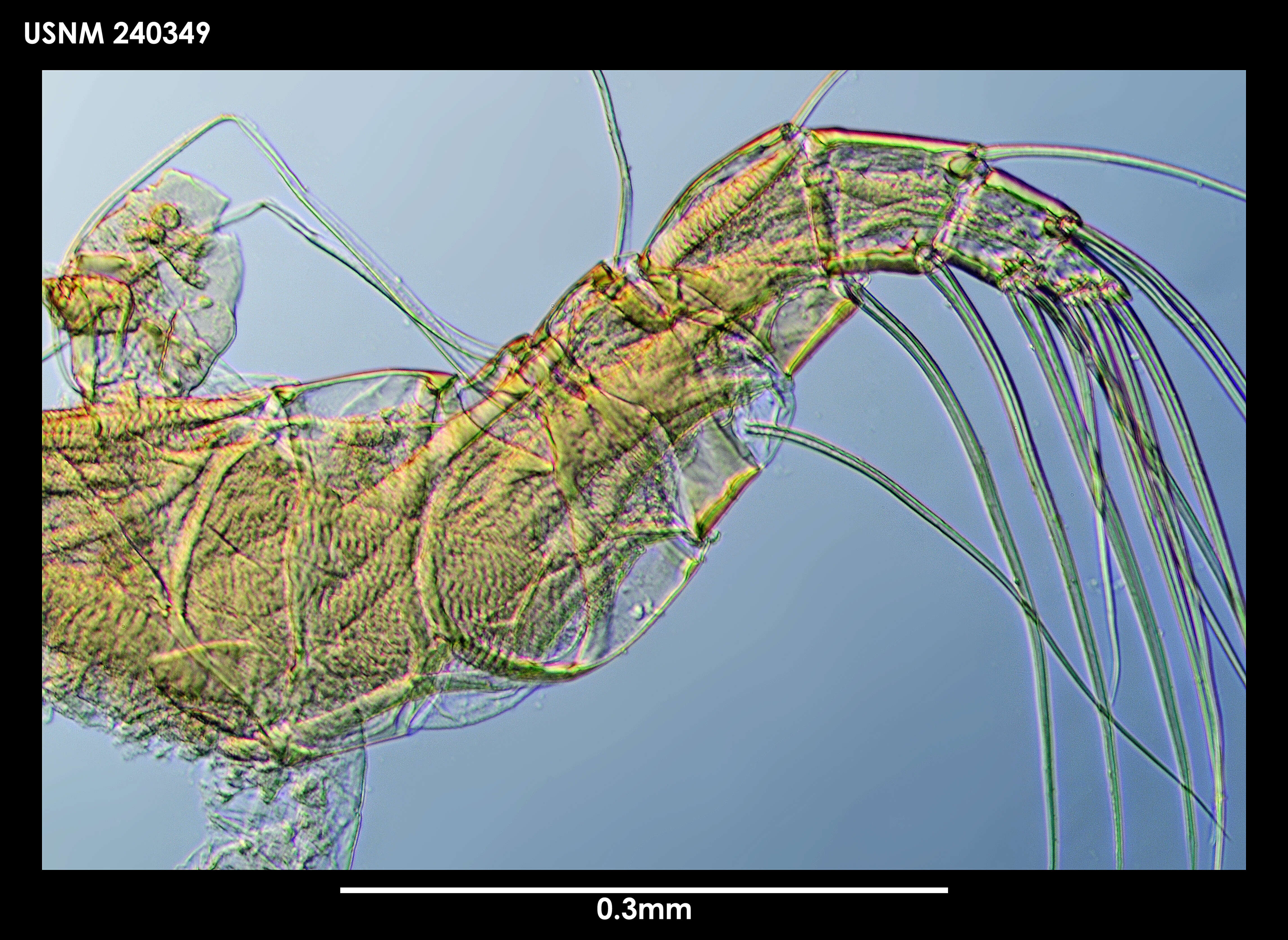 Imagem de Macromckenziea glacierae Maddocks 1990