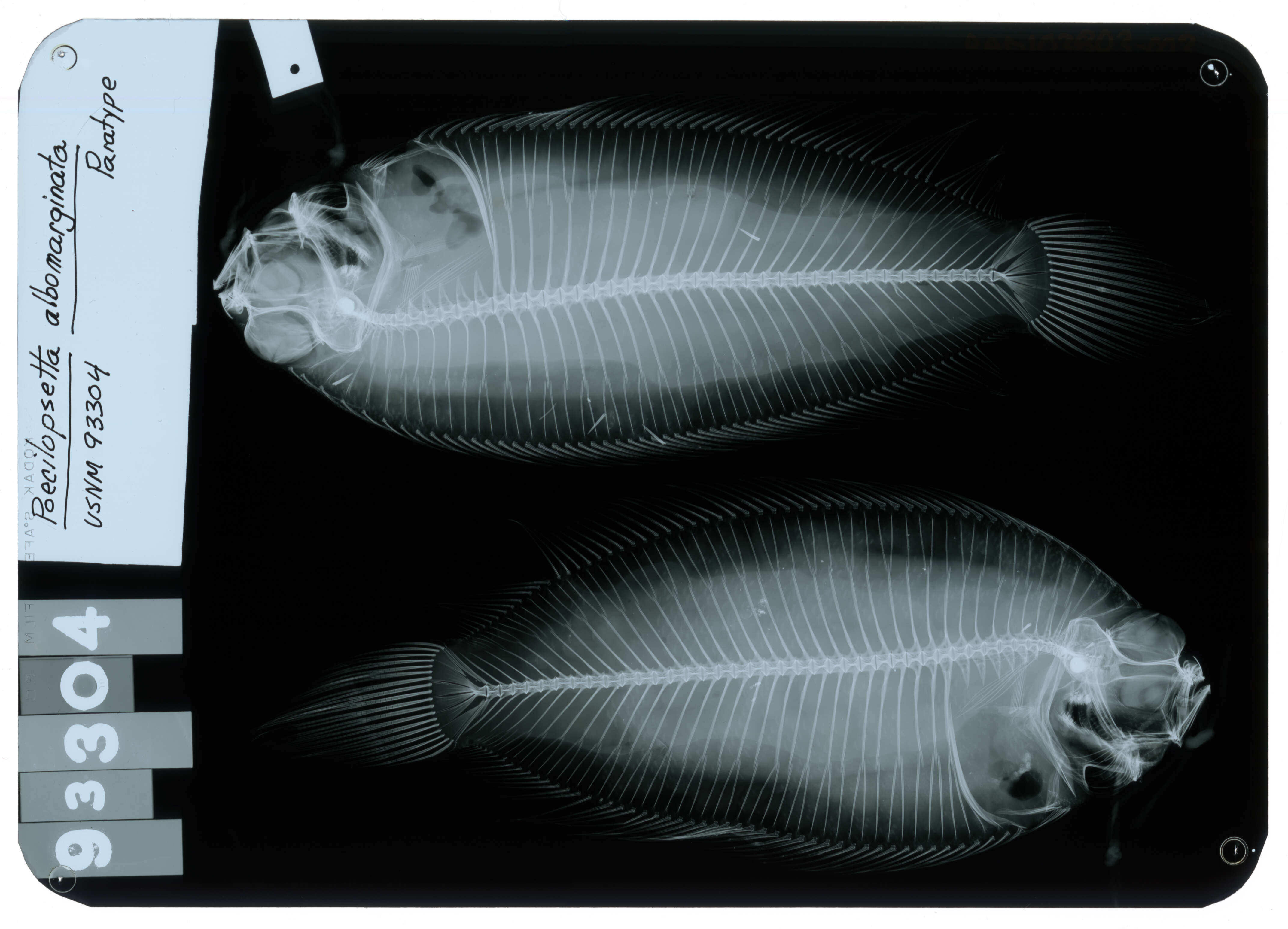 Poecilopsetta inermis (Breder 1927) resmi