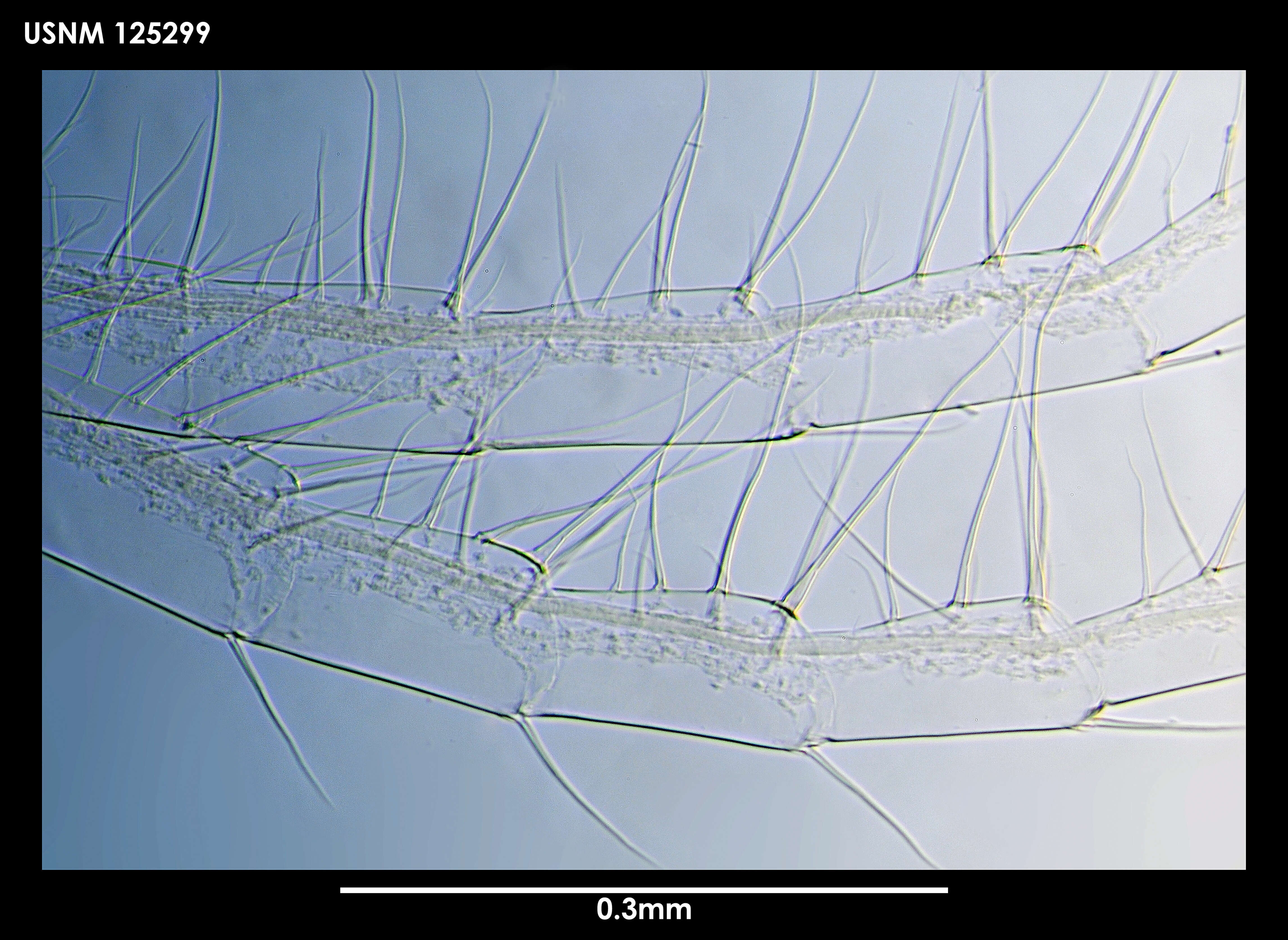 Image of Brochia bulata Newman & Ross 1971