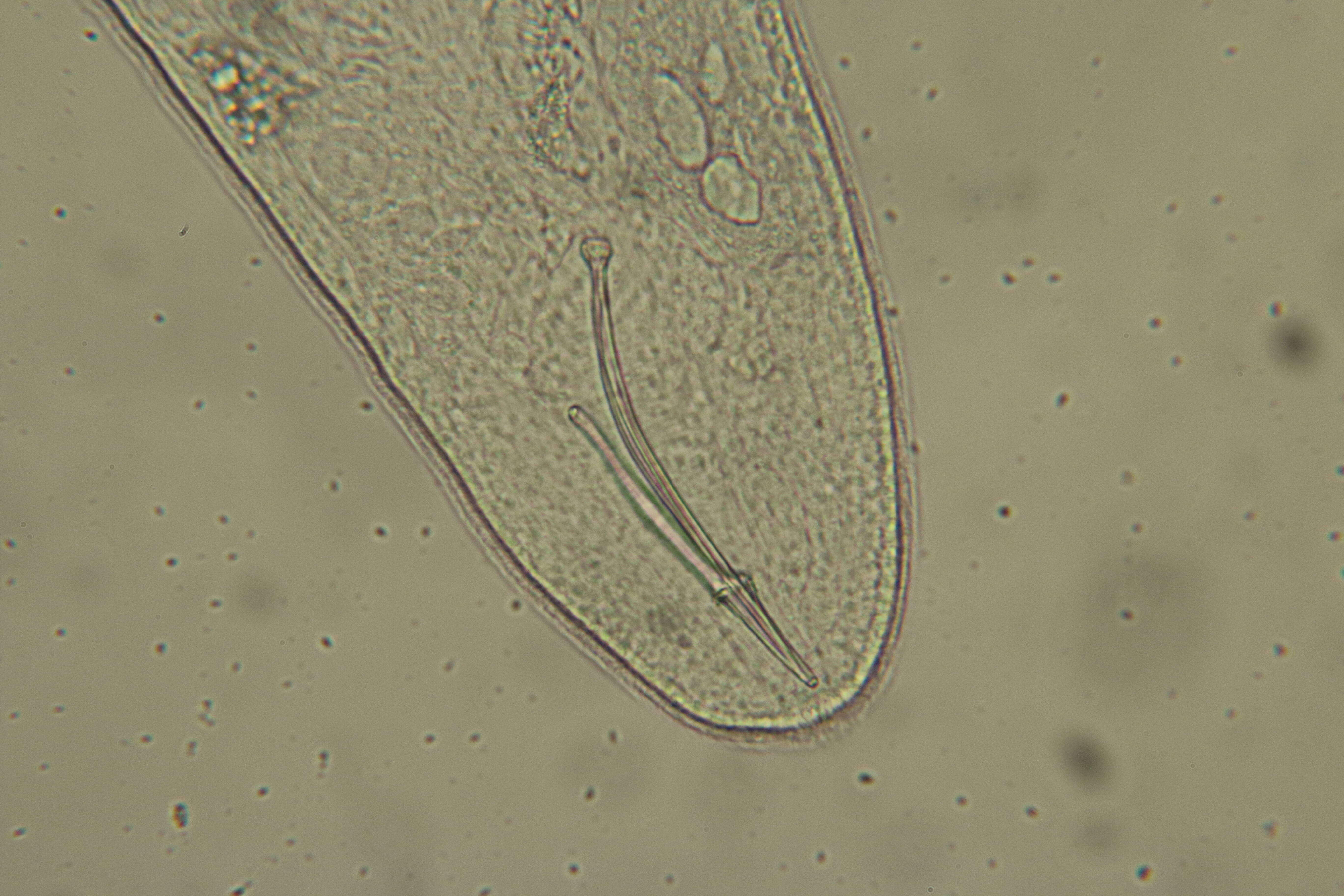 Image of unclassified Platyhelminthes