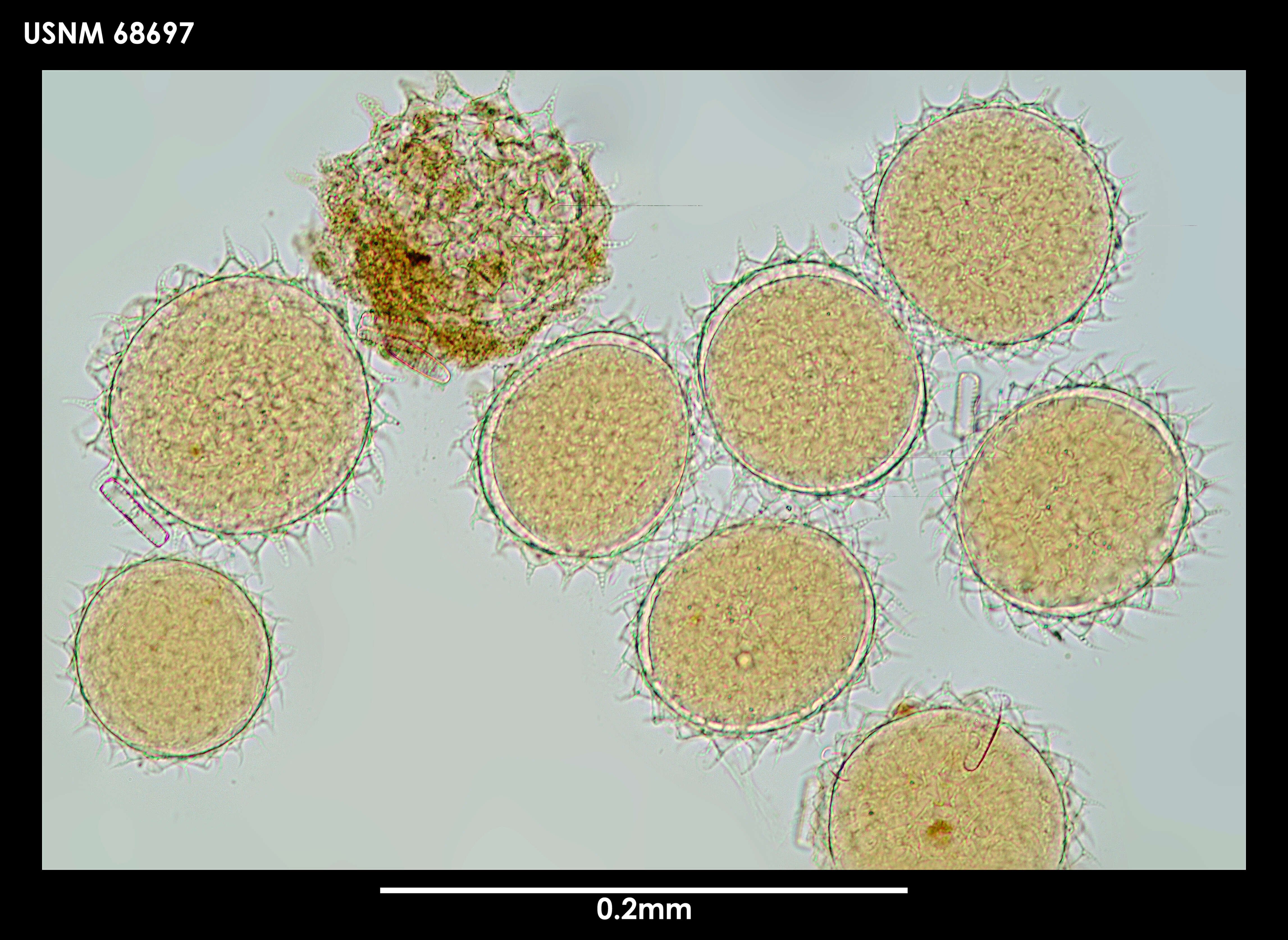 Macrobiotus blocki Dastych 1984 resmi