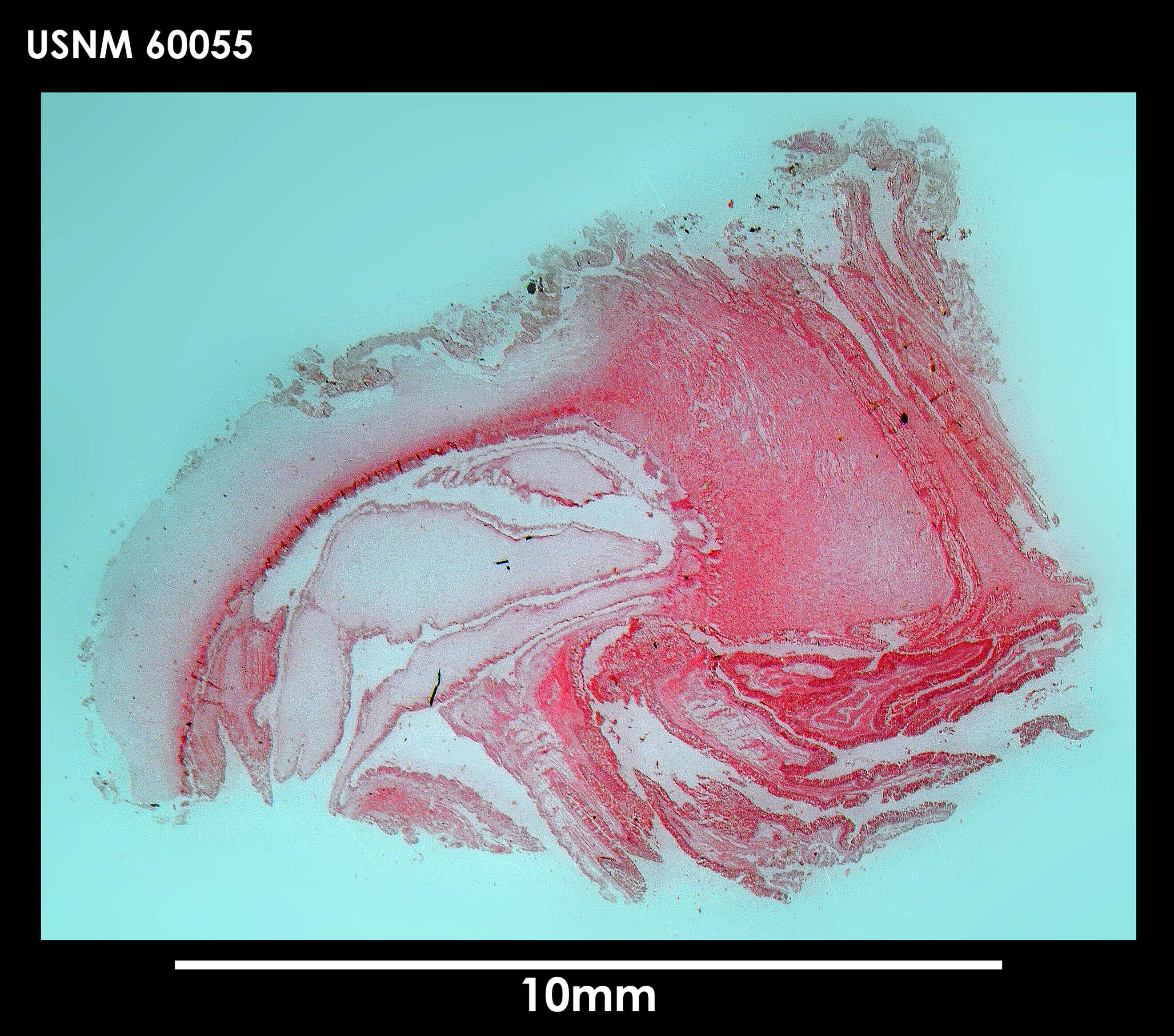 Hormosoma scotti Stephenson 1918的圖片