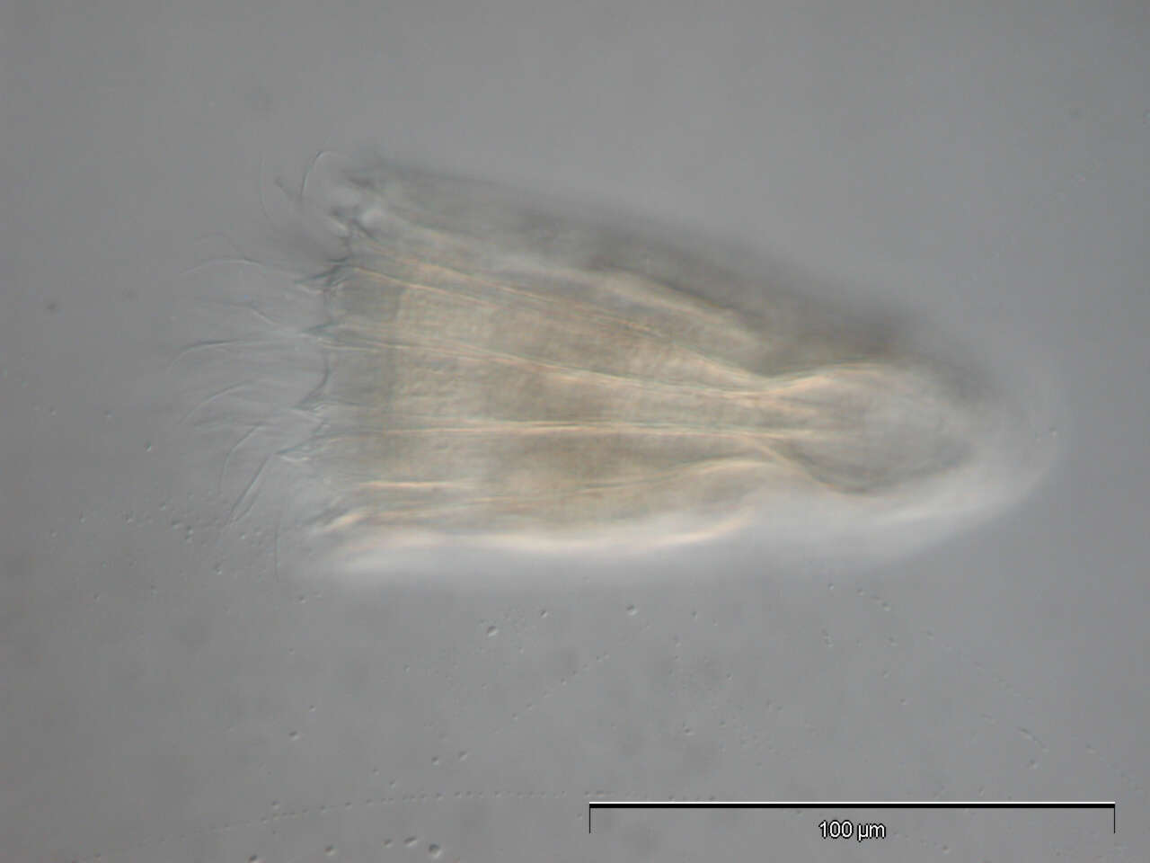 Image of Spinoloricus Heiner & Neuhaus 2007