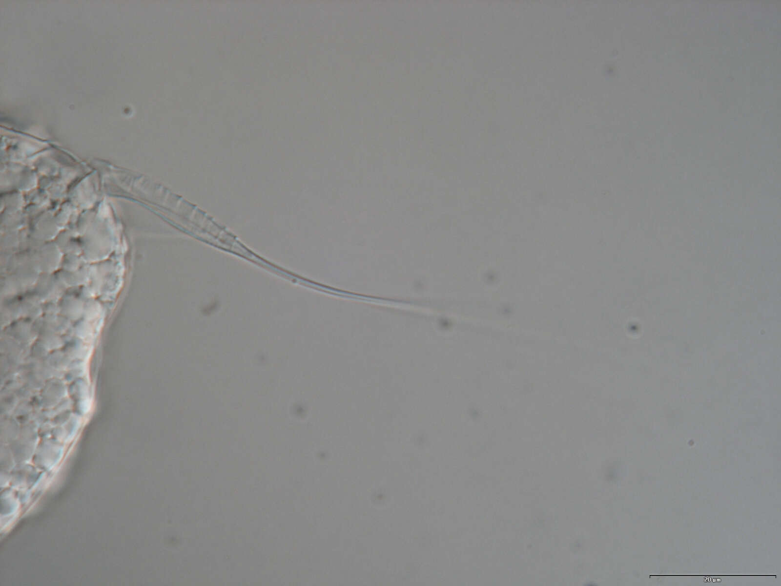 Image of loriciferans