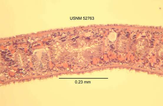 Image of Procotyla typhlops Kenk 1935