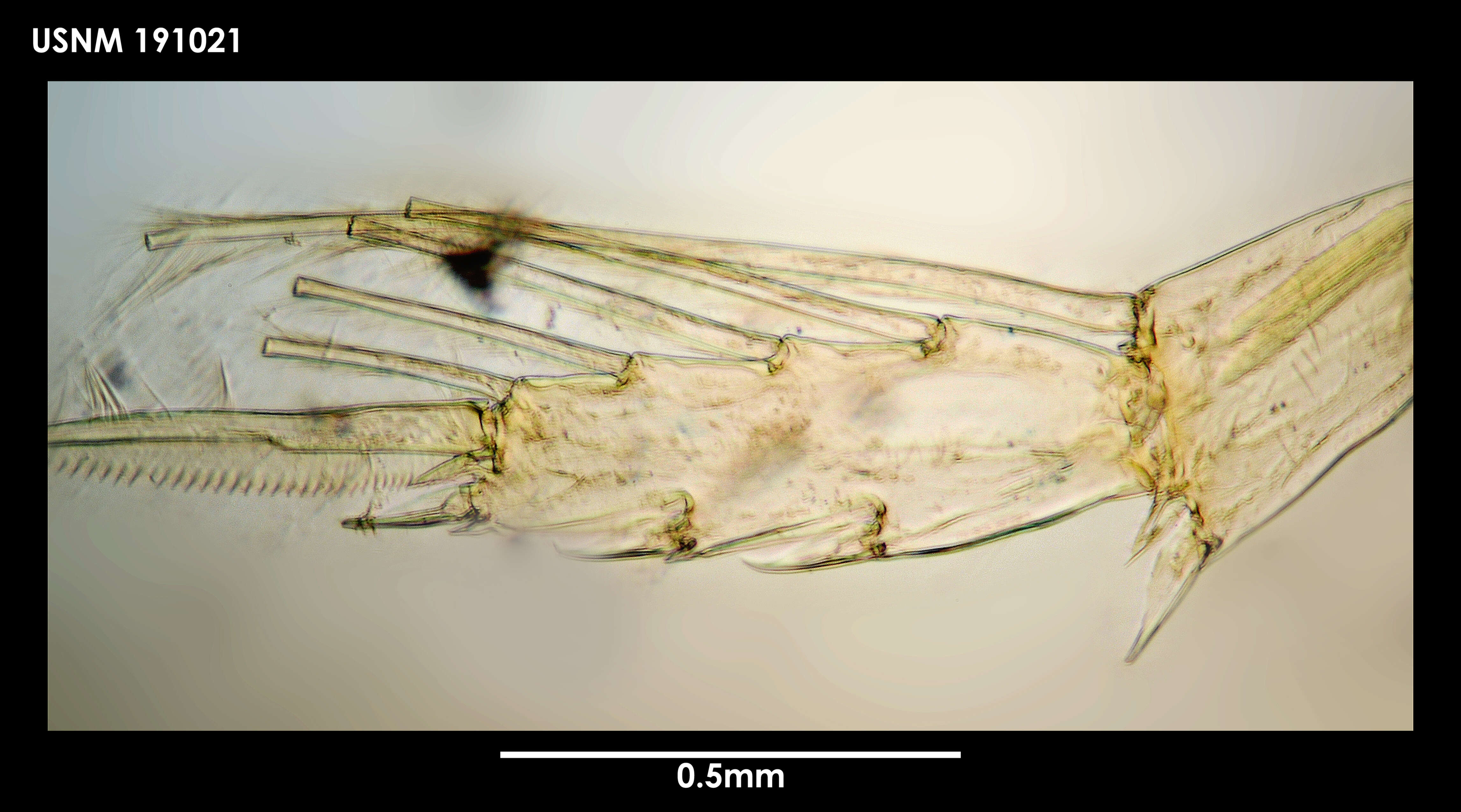 Image de Xanthocalanus harpagatus Bradford & Wells 1983