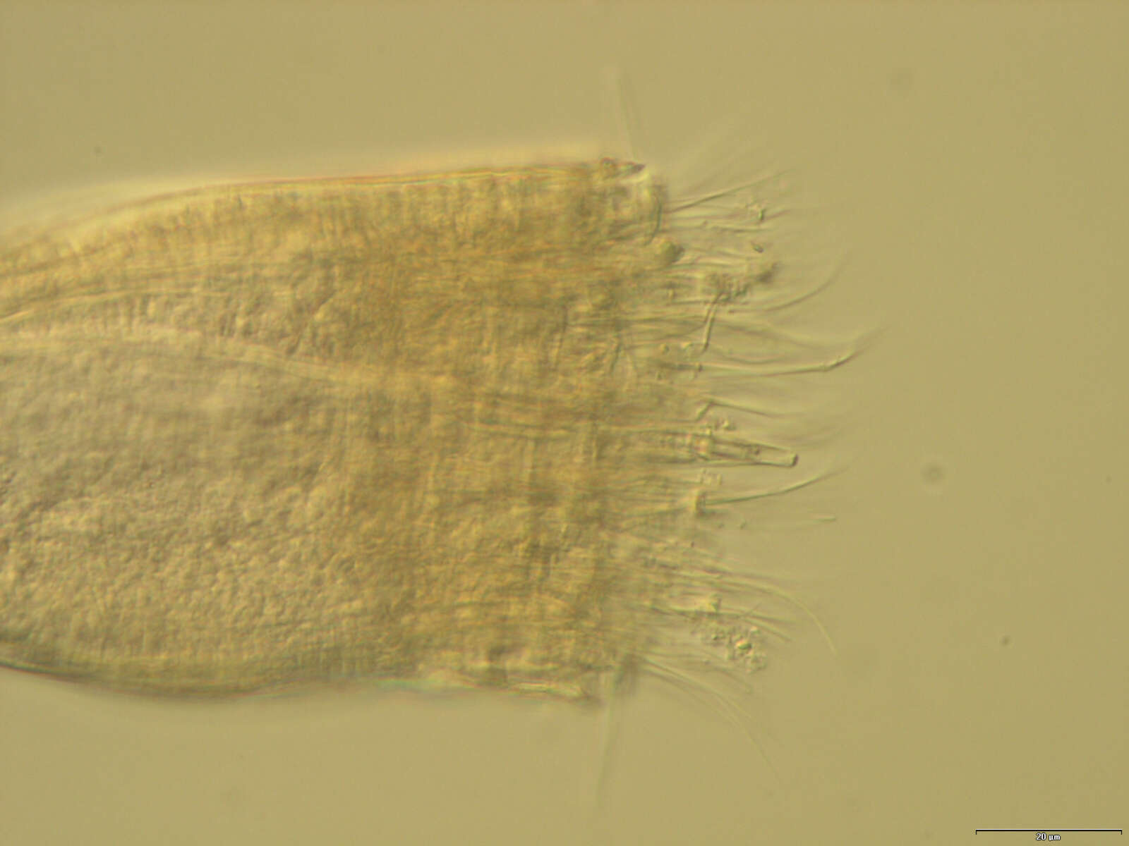 Image of Spinoloricus Heiner & Neuhaus 2007