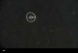 Image of segmented worms
