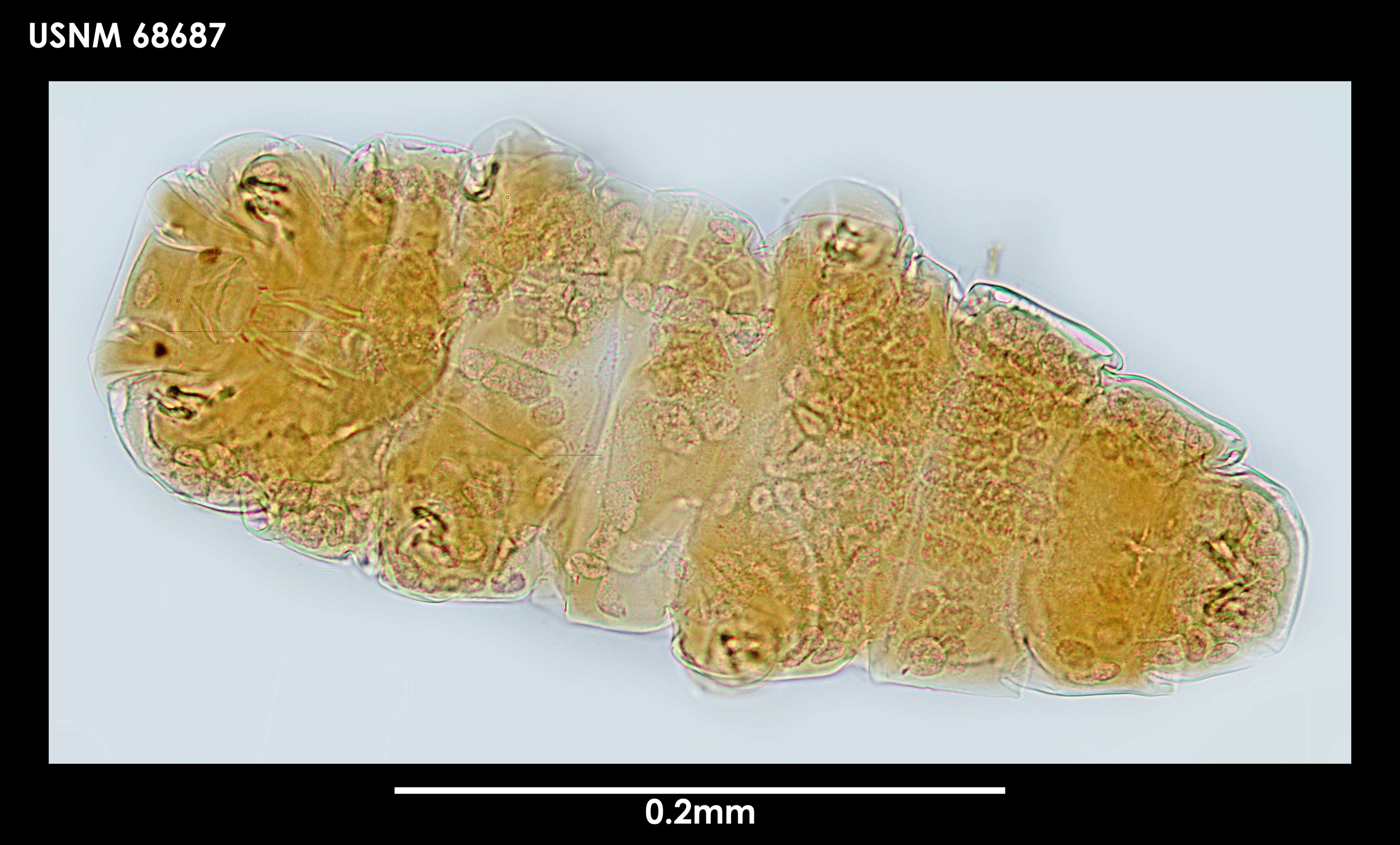 Image of Milnesium tardigradum Doyère 1840