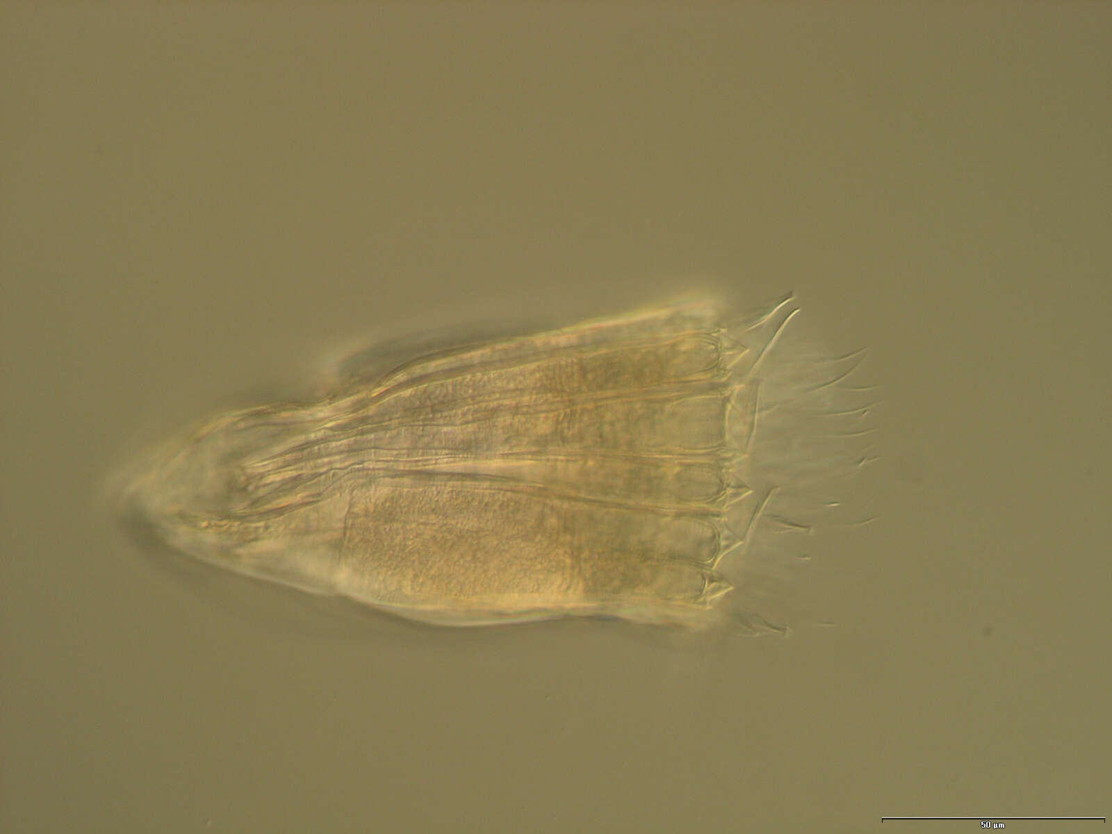 Image of Spinoloricus Heiner & Neuhaus 2007