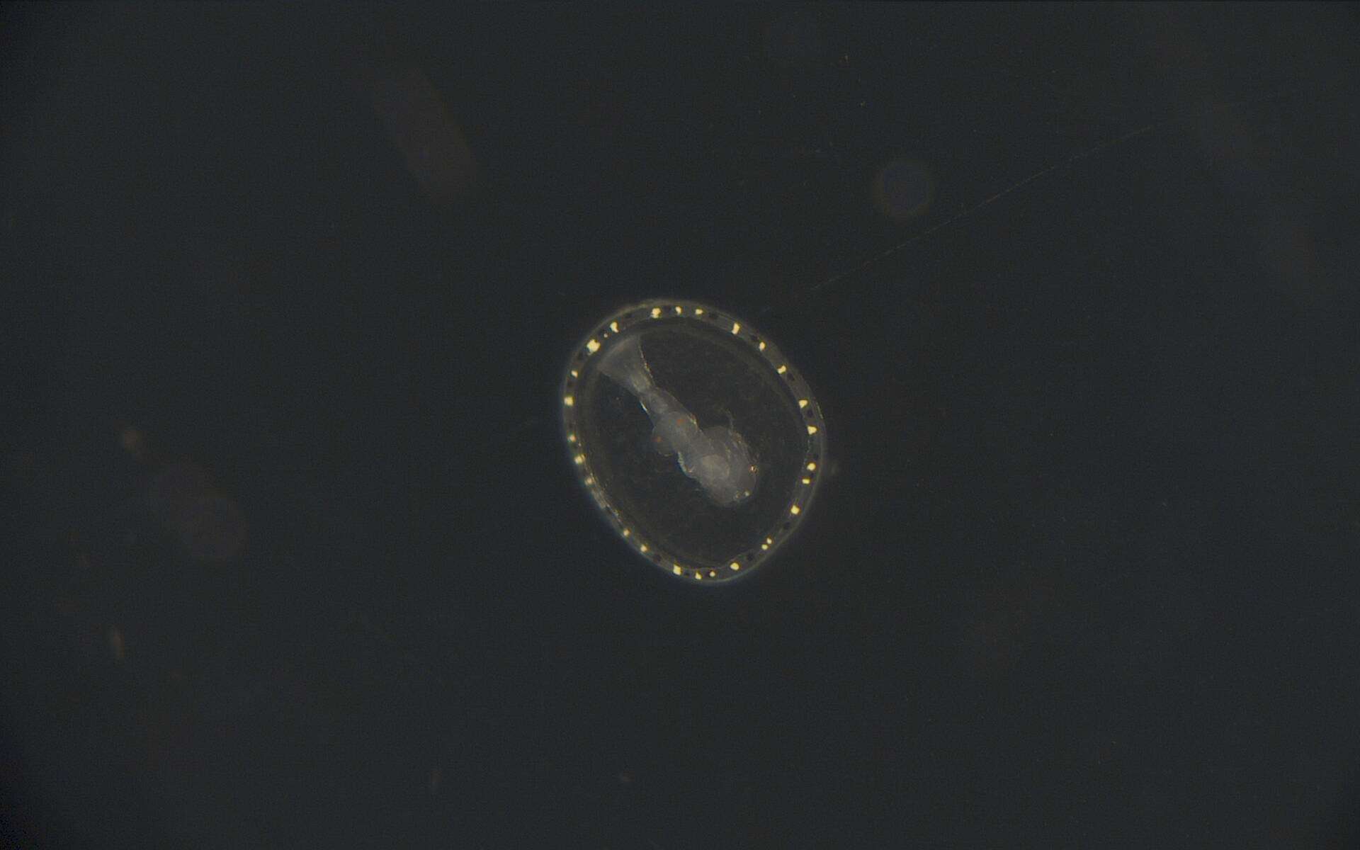 Image of segmented worms