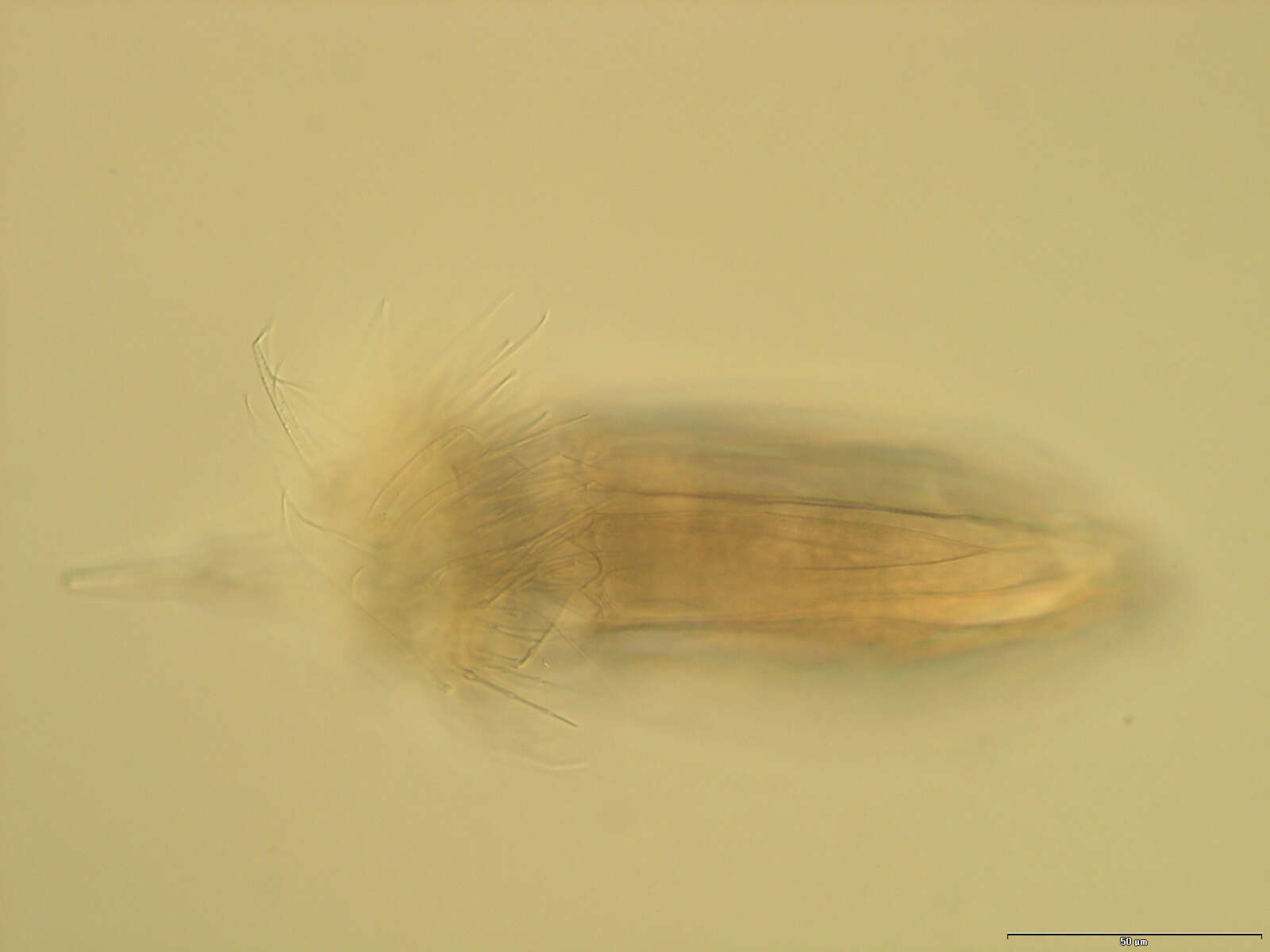 Image of Spinoloricus Heiner & Neuhaus 2007