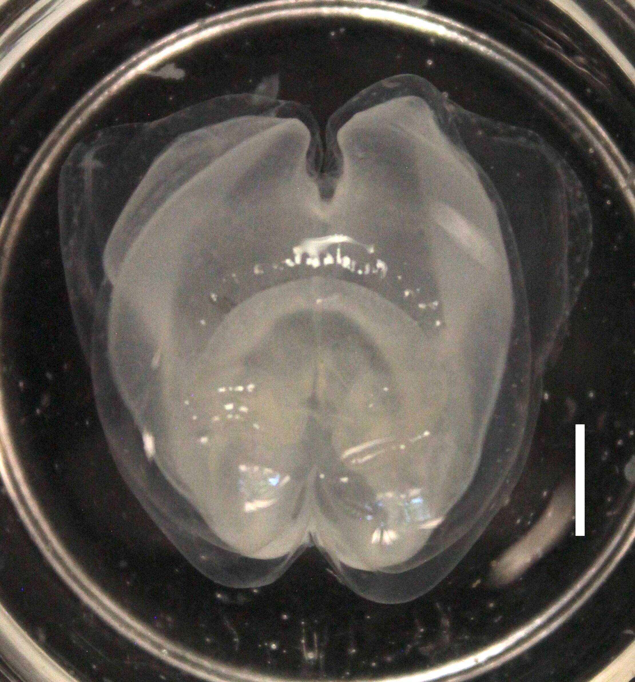 Sivun Apolemia lanosa Siebert, Pugh, Haddock & Dunn 2013 kuva