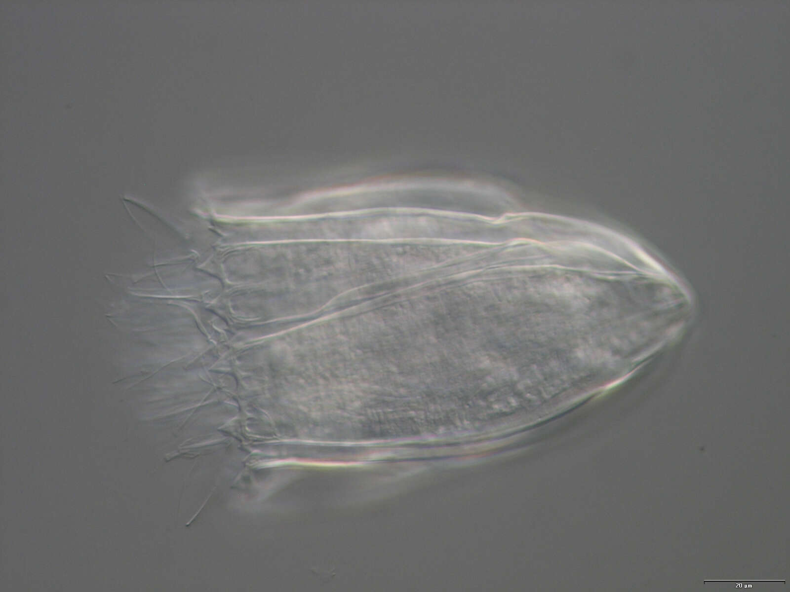 Image of Spinoloricus Heiner & Neuhaus 2007