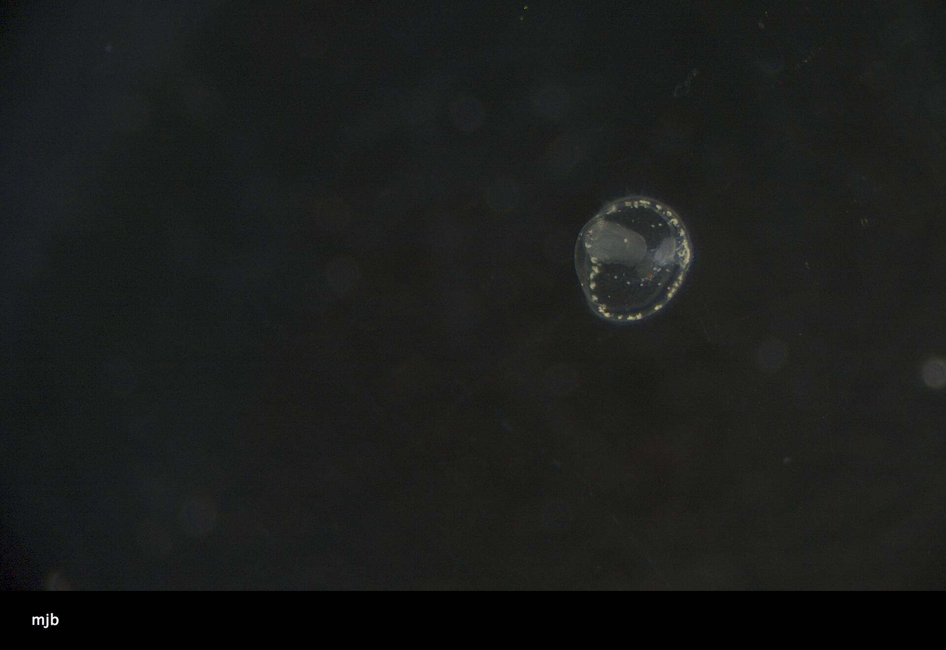 Image of segmented worms