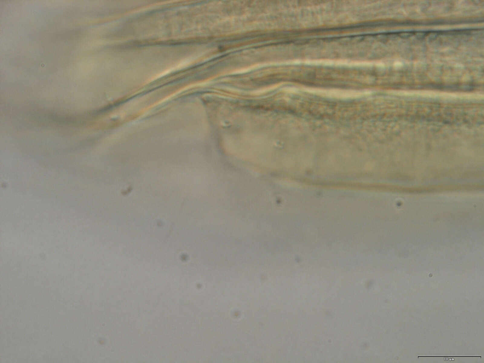 Image of Spinoloricus Heiner & Neuhaus 2007