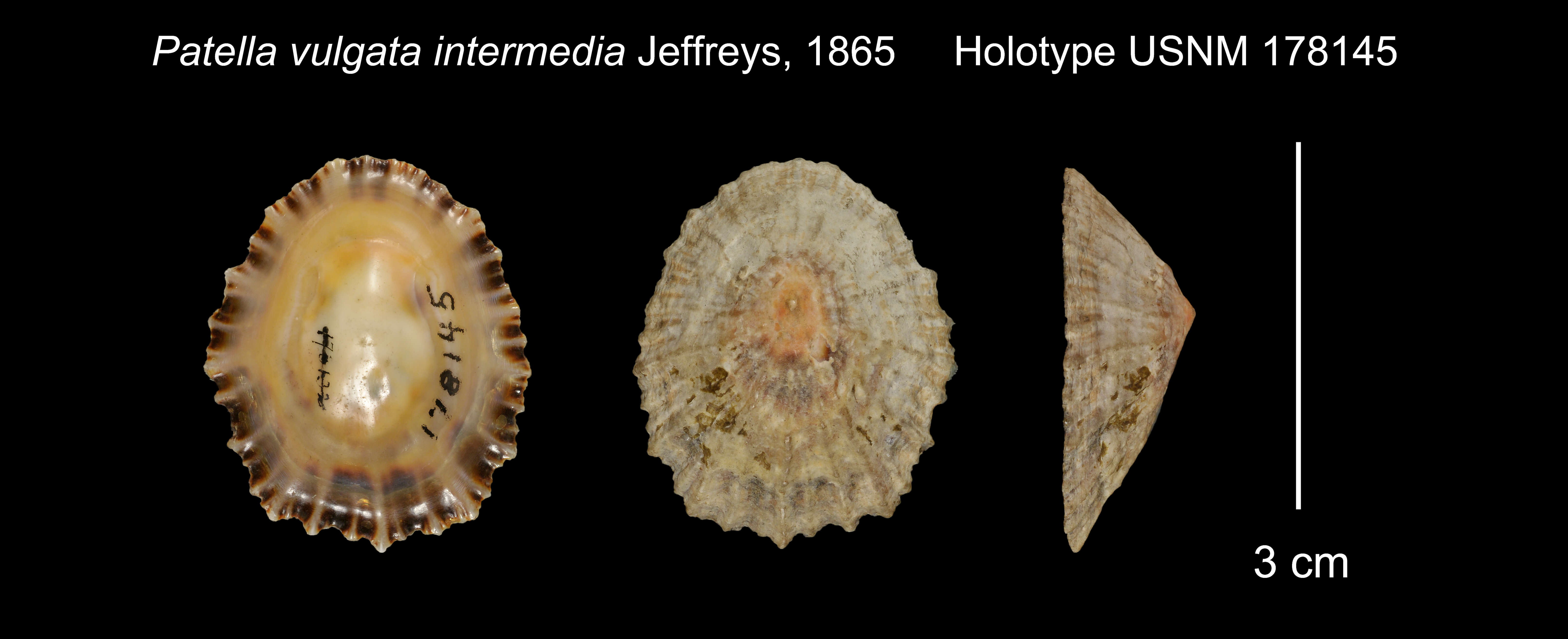 Image of Patella vulgata var. intermedia Murray 1857
