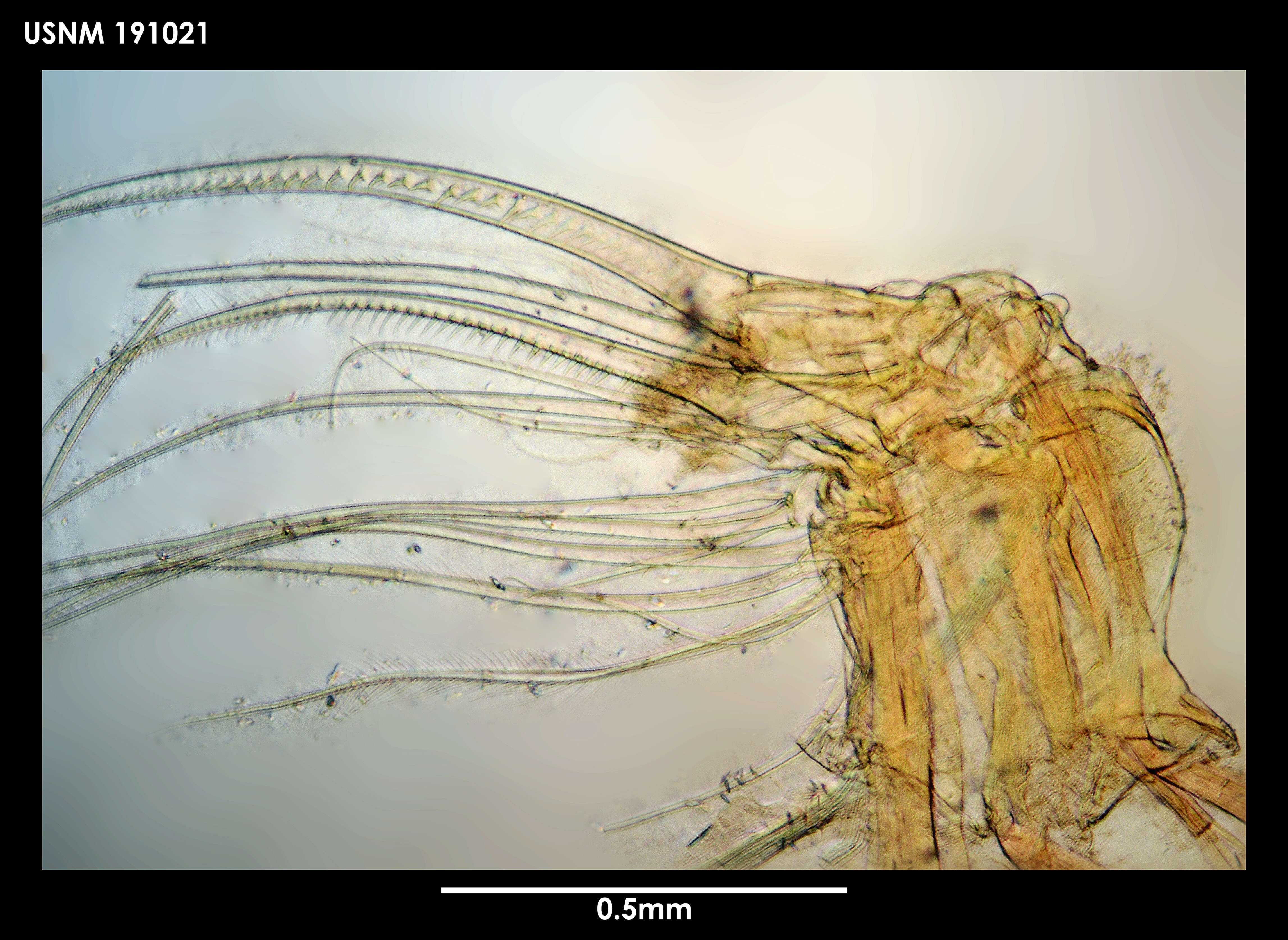 Image of Xanthocalanus harpagatus Bradford & Wells 1983