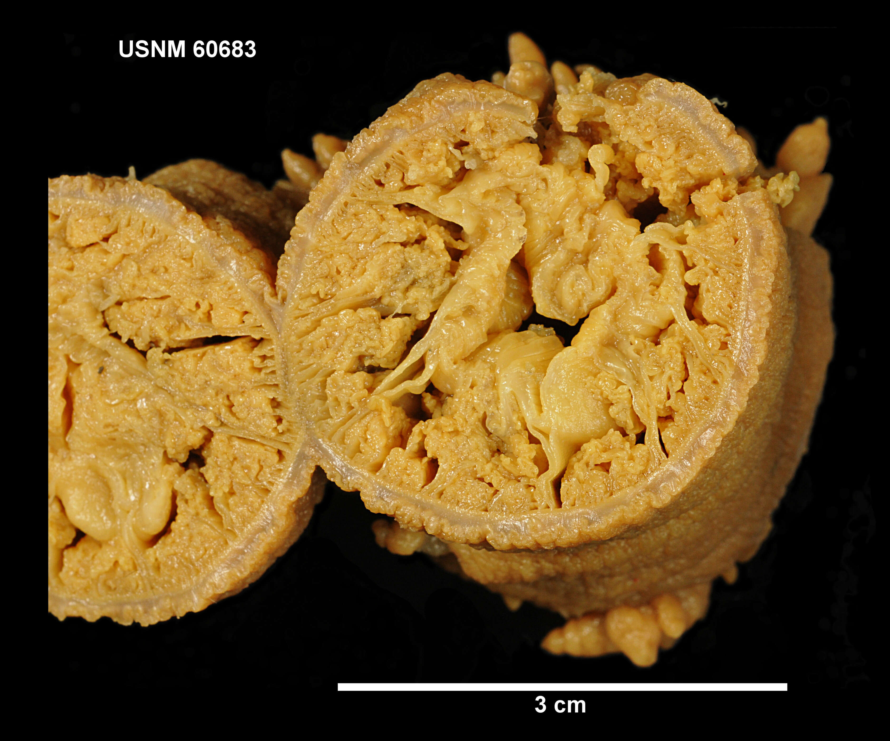 Image of Glyphoperidium bursa Roule 1909